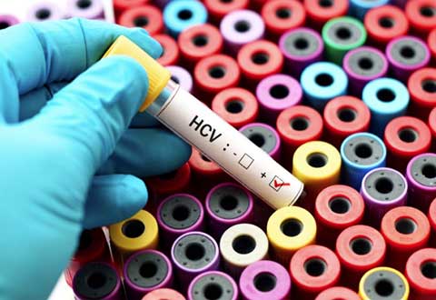 Govt intervenes to keep hep C elimination on track