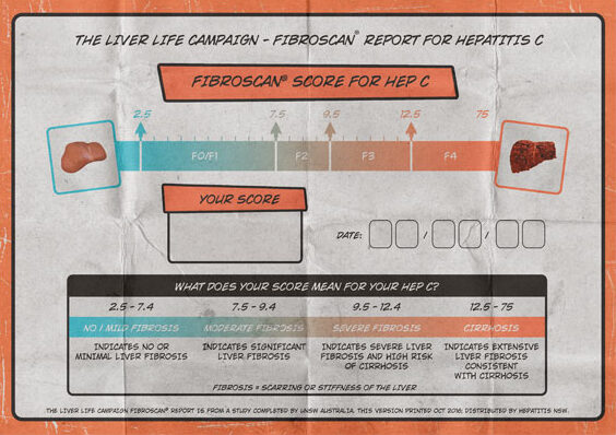 Hep C Fibroscan score card|The liver life campaign - fibroscan report for hepatitis C