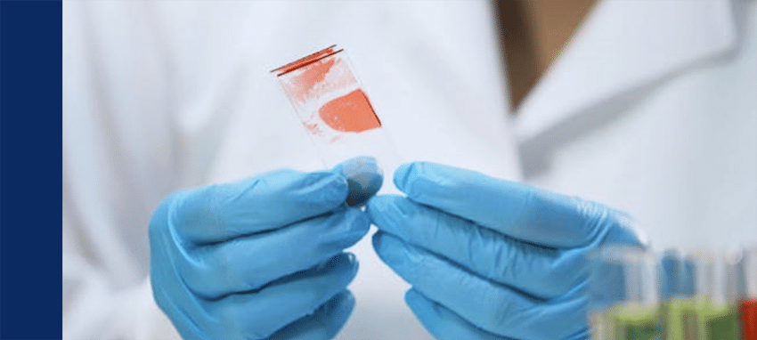 BBV in the workplace